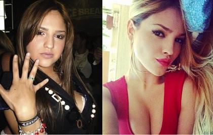 eiza gonzalez antes y despues nariz