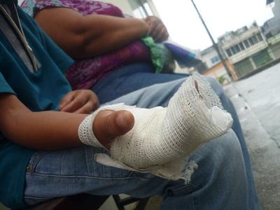 A menor de 13 años le explotó una camareta en su mano en Santo Domingo