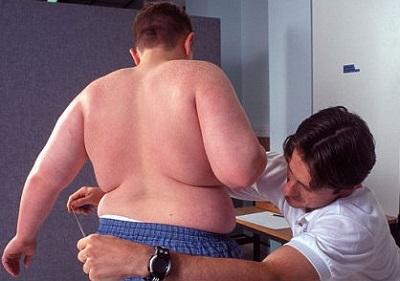 Niños de padres divorciados son más propensos a ser obesos, según estudio