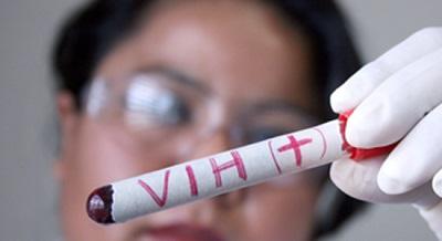 Existen 65 nuevos casos de VIH en Santo Domingo de los Tsáchilas