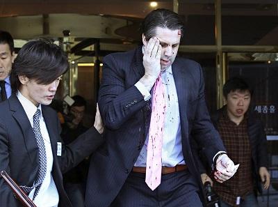 Activista radical apuñala en la cara al embajador de EE.UU. en Corea del Sur
