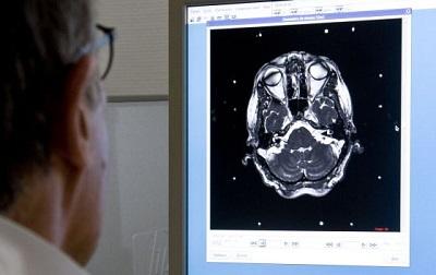 Encuentran un posible tratamiento para un tumor cerebral letal en niños