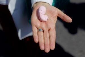 La venta de tejido fetal activa el debate sobre el aborto en EE.UU.