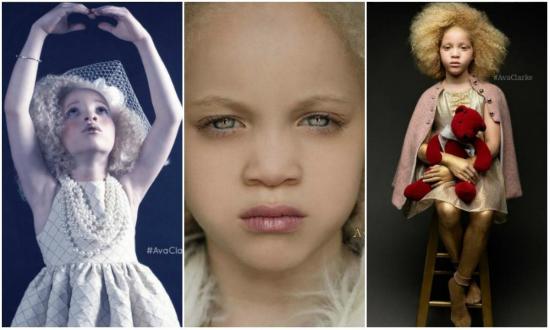 Ava, la niña albina con raíces afroamericanas que revoluciona la moda
