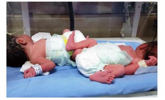 Mujer de 58 años dio a luz gemelos en el estado mexicano de Sinaloa