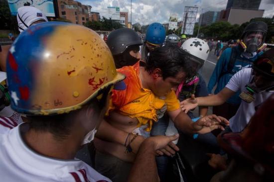 Diputado opositor venezolano es herido durante una marcha en Caracas