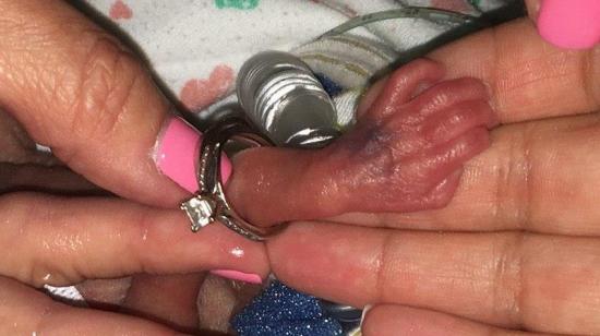 La 'niña milagro' que pesó 368 gramos al nacer recibe el alta médica