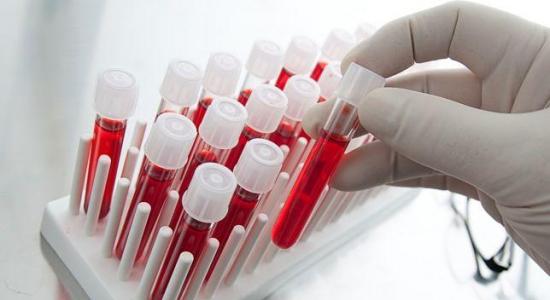 Crean un test de sangre capaz de detectar de forma temprana 8 tipos de cáncer