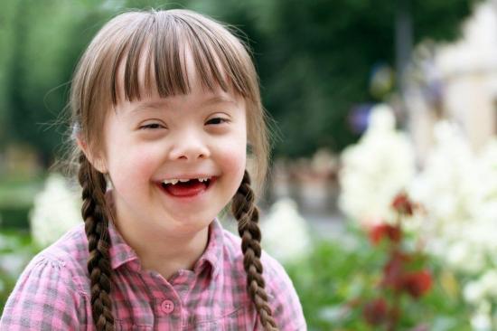 Un tratamiento adecuado del síndrome de Down garantiza buena calidad de vida