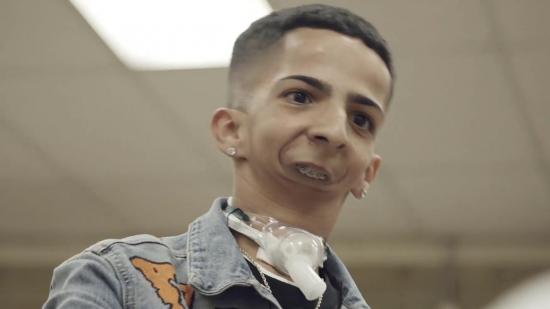 Joven sin mandíbula que escribe rap es nominado en premios para inspiradores