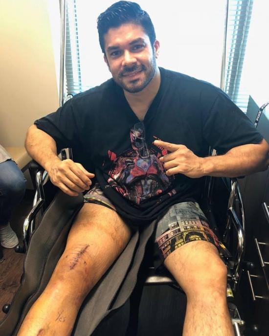 Jerry Rivera se recupera de su cirugía en la rodilla luego de su caída en Ecuador