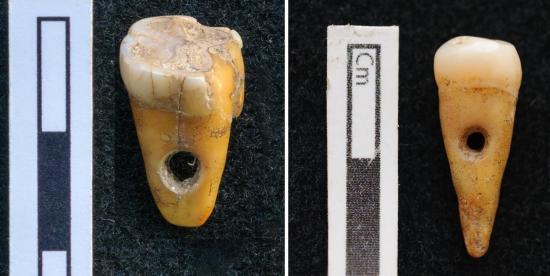 Dientes humanos usados como joyería en Turquía hace 8.500 años
