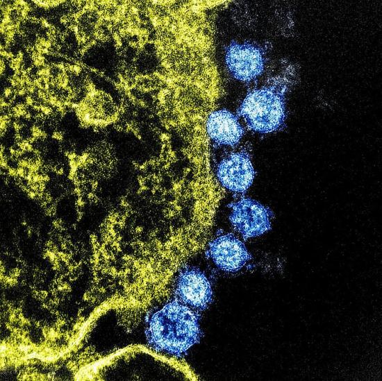 Científicos de EEUU creen que una vacuna preliminar contra el nuevo coronavirus podría estar lista en 3 meses