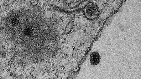 Descubren en Brasil el Yaravirus, un misterioso virus que no representa riesgo para el hombre