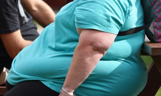 Experto dicen que las personas con sobrepeso tienen más riesgo de complicaciones por Covid-19