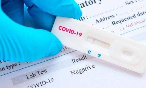 El Municipio de Portoviejo adquirió 5 mil pruebas rápidas de detección de coronavirus