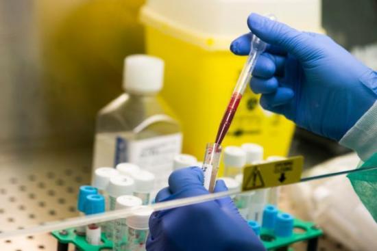 La OMS anuncia reanudación de ensayos clínicos con hidroxicloroquina contra Covid-19