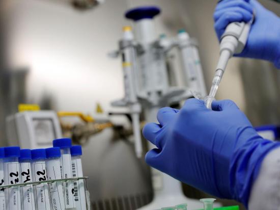 Rusia espera sacar la primera vacuna contra el COVID-19 antes de octubre