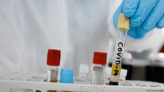 Alemania dona a Costa Rica 100.000 pruebas PCR para coronavirus